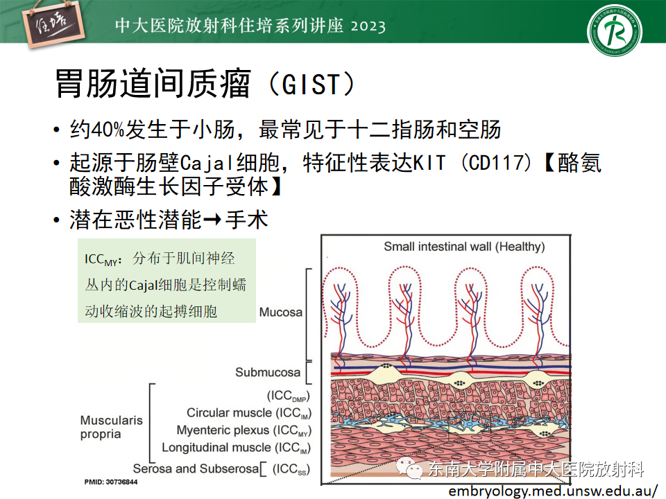 影像PPT - 【PPT】常见十二指肠占位影像诊断-16