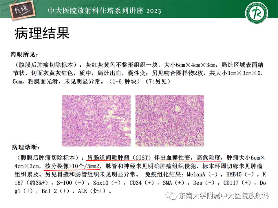 影像PPT - 【PPT】常见十二指肠占位影像诊断-22