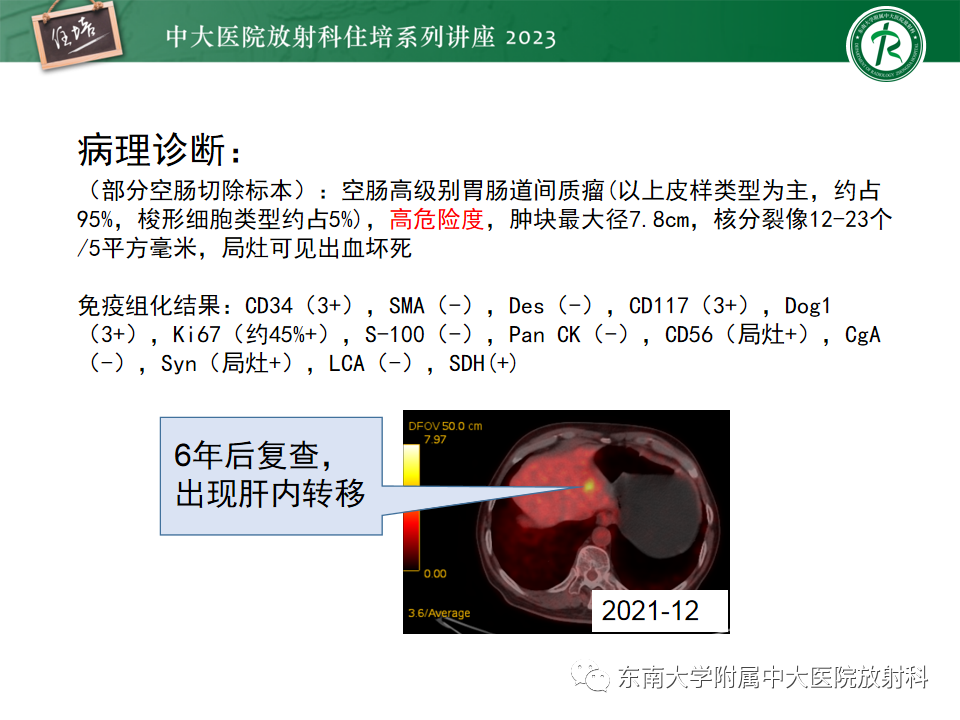 影像PPT - 【PPT】常见十二指肠占位影像诊断-27