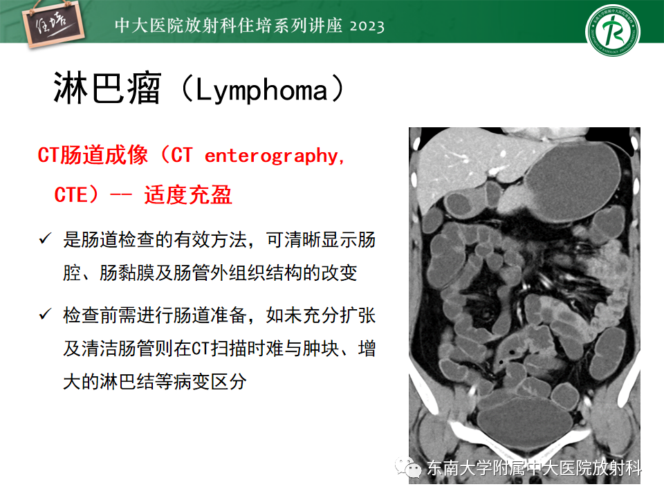 影像PPT - 【PPT】常见十二指肠占位影像诊断-31