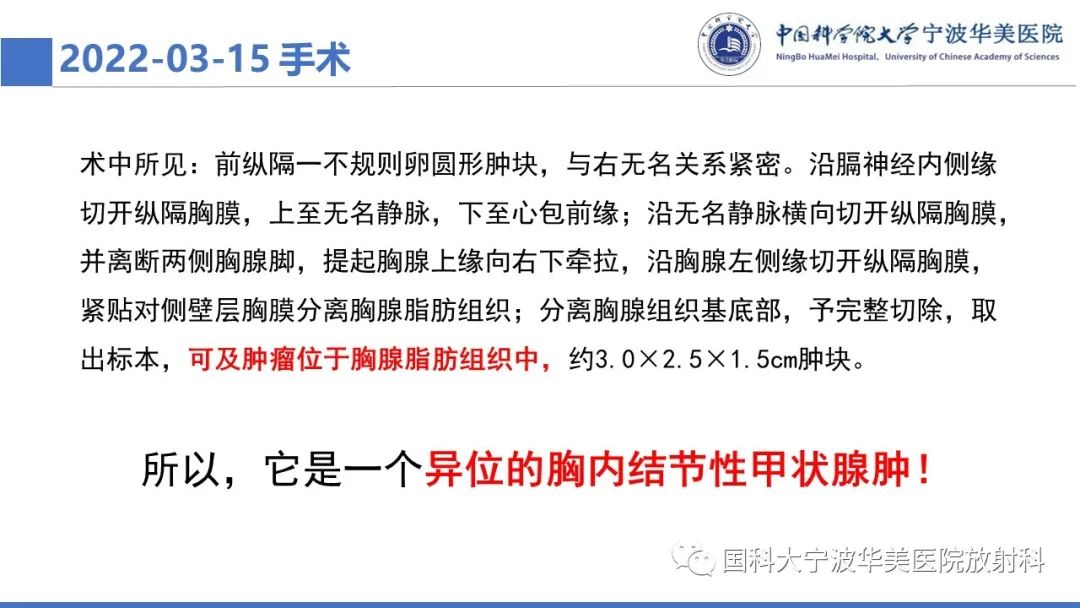 影像PPT - 【PPT】胸内甲状腺肿影像学表现-12