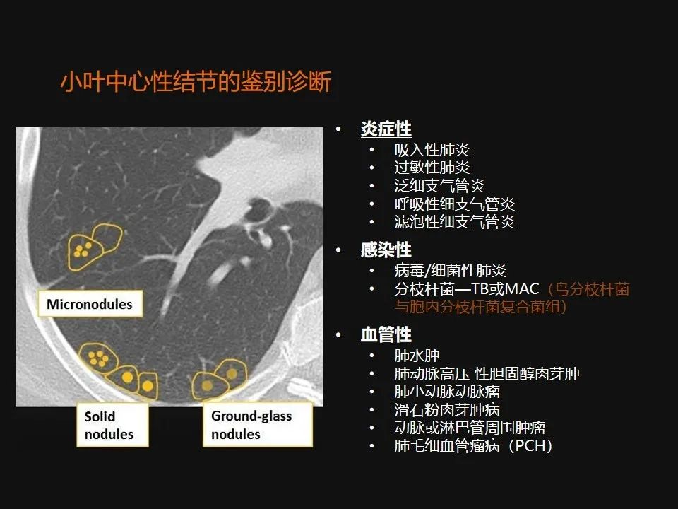 影像PPT - 【PPT】肺微结节的HRCT诊断及鉴别诊断思路-10 影像PPT - 【PPT】肺微结节的HRCT诊断及鉴别诊断思路-10