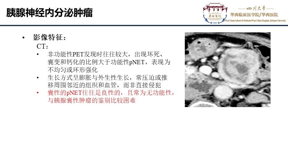 影像PPT - 【PPT】胰腺神经内分泌肿瘤-11