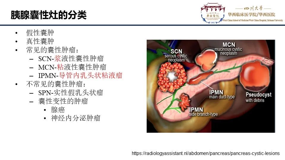 影像PPT - 【PPT】胰腺神经内分泌肿瘤-14