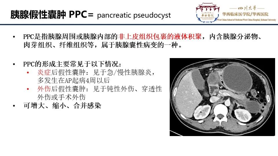 影像PPT - 【PPT】胰腺神经内分泌肿瘤-15