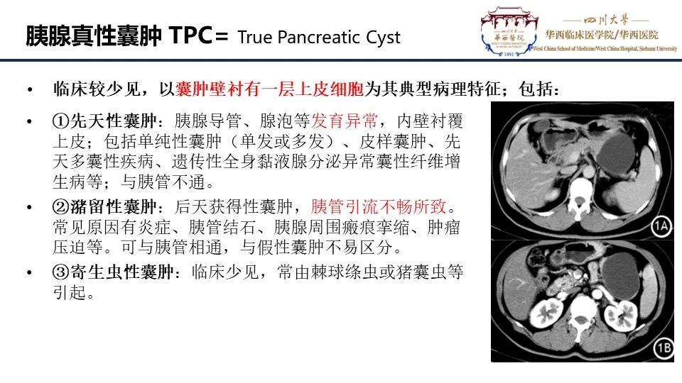 影像PPT - 【PPT】胰腺神经内分泌肿瘤-16