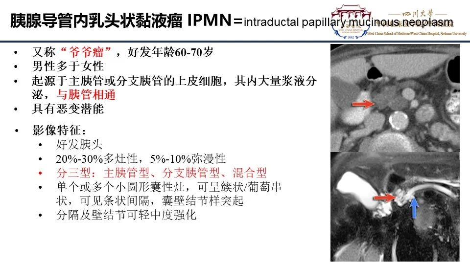 影像PPT - 【PPT】胰腺神经内分泌肿瘤-19