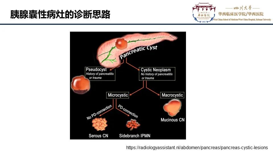 影像PPT - 【PPT】胰腺神经内分泌肿瘤-21