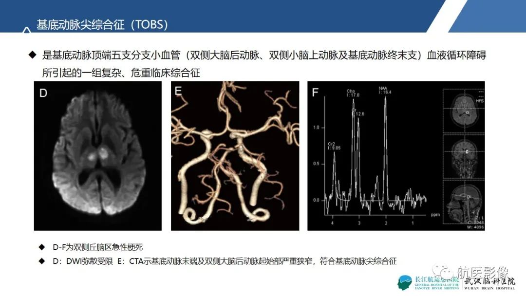 影像PPT - 【PPT】基底节区、丘脑对称性病变影像表现-25