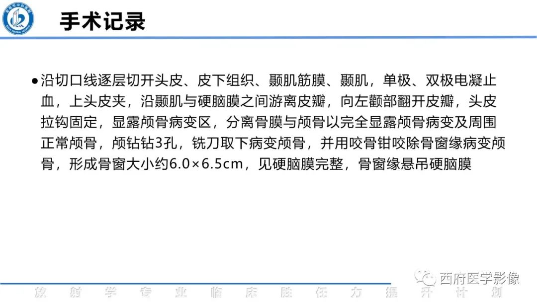 影像PPT - 【病例】颅骨血管瘤1例CT及MR影像诊断与鉴别-8