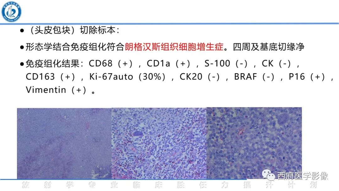 影像PPT - 【病例】颅骨血管瘤1例CT及MR影像诊断与鉴别-27
