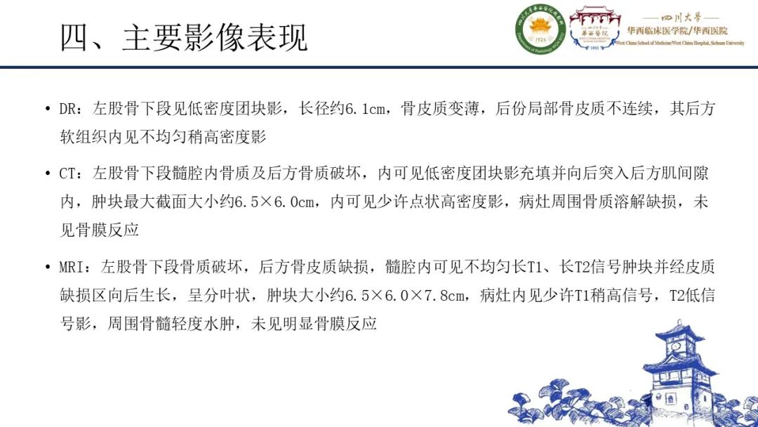 影像PPT - 【病例】黑色素性外周神经鞘膜肿瘤1例X线CT及MR影像-13