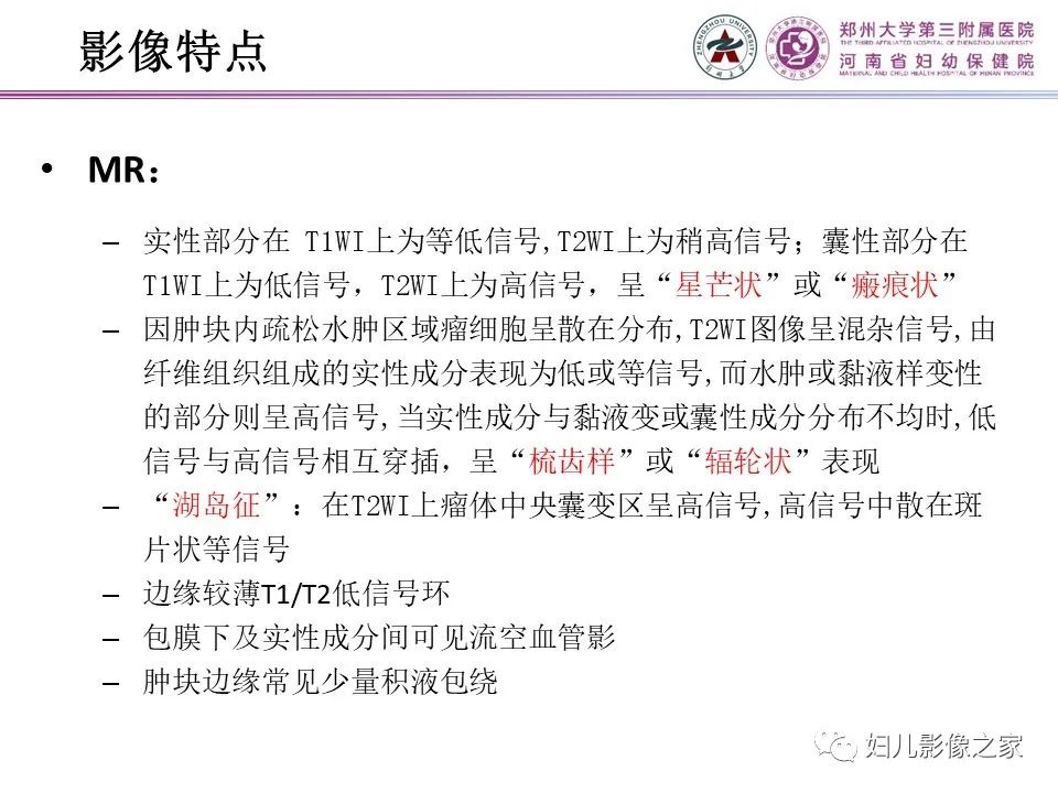 影像PPT - 【PPT】卵巢硬化性间质瘤-10