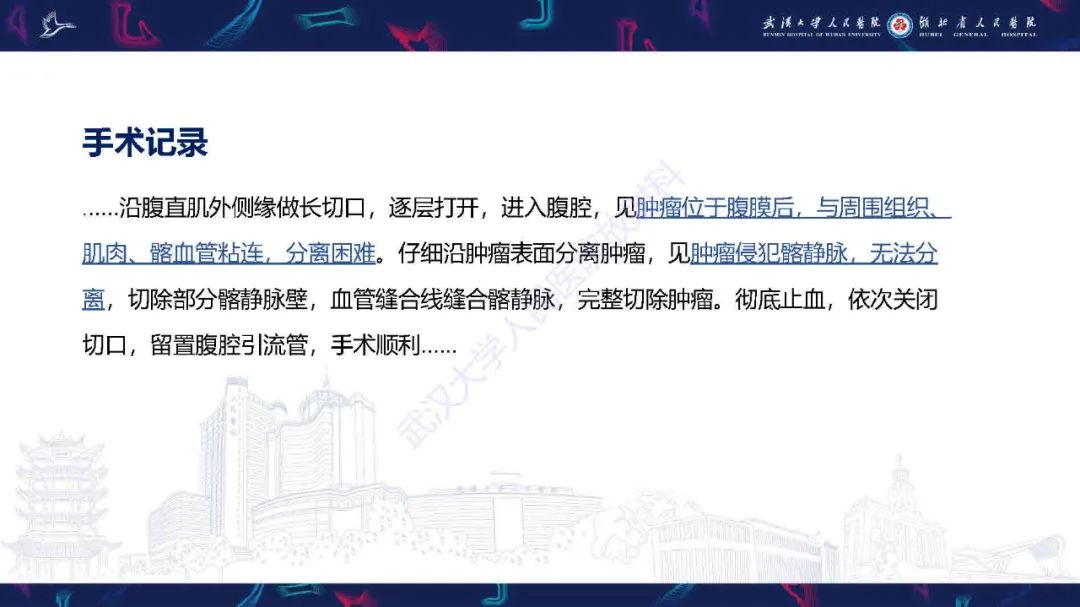 影像PPT - 【PPT】腹膜间皮瘤影像诊断-4