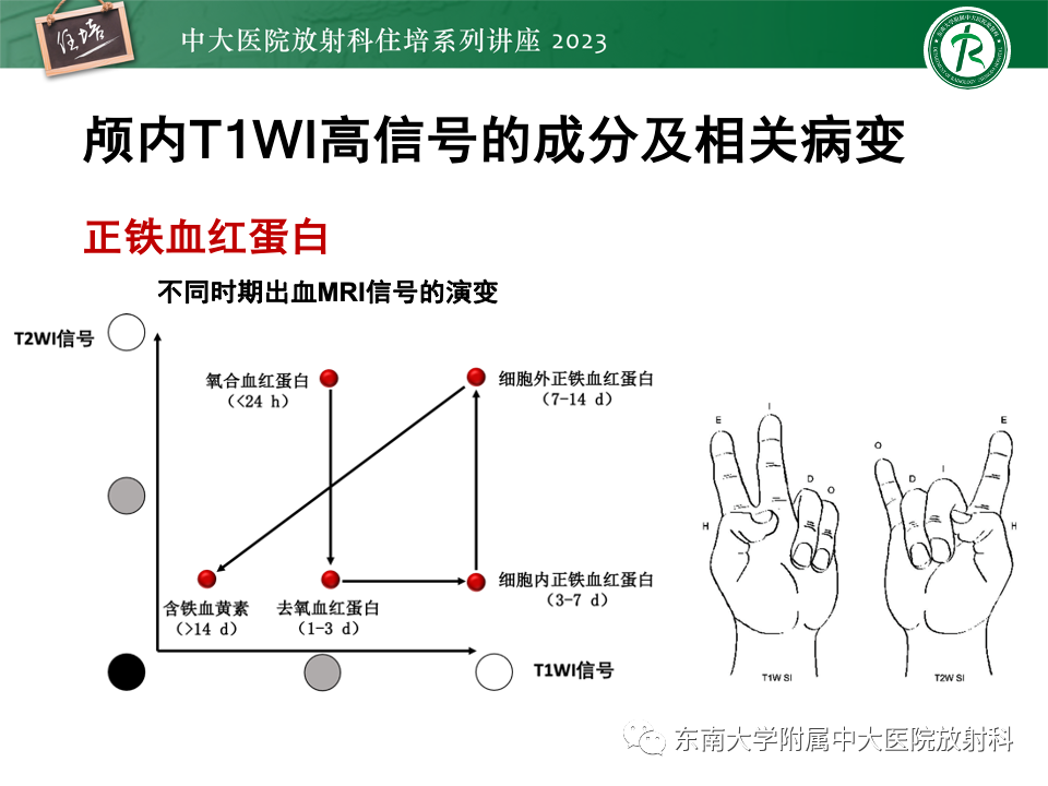影像PPT - 【PPT】成人颅内T1WI高信号病变分析思路-5