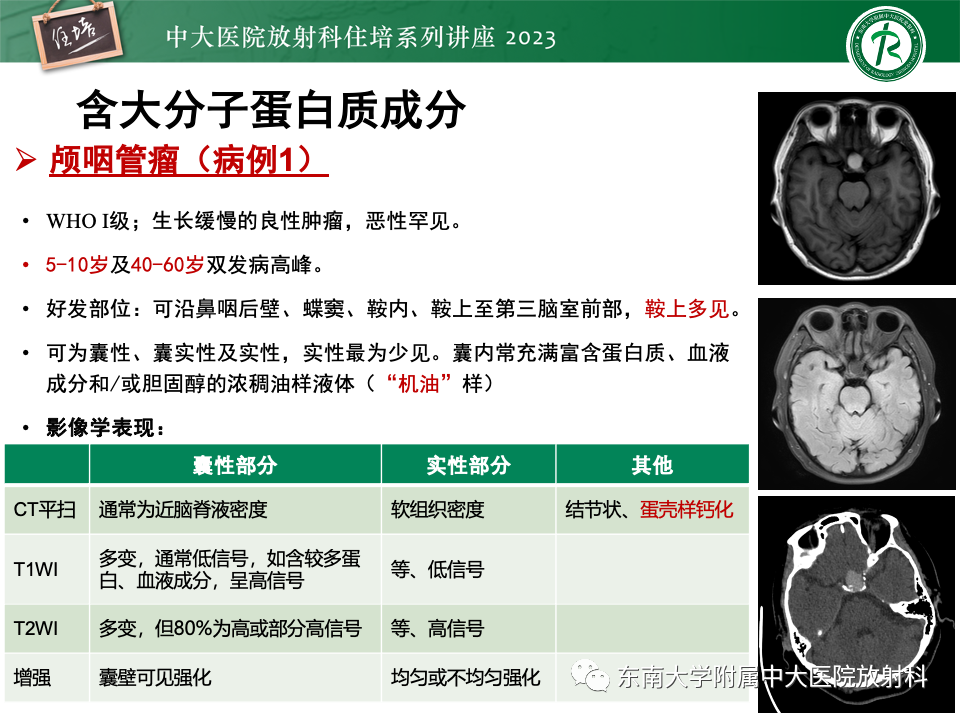 影像PPT - 【PPT】成人颅内T1WI高信号病变分析思路-13