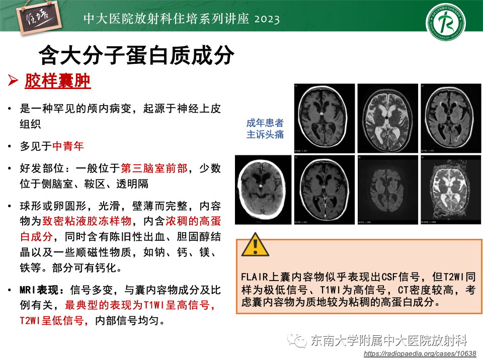 影像PPT - 【PPT】成人颅内T1WI高信号病变分析思路-17