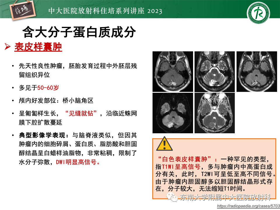 影像PPT - 【PPT】成人颅内T1WI高信号病变分析思路-18