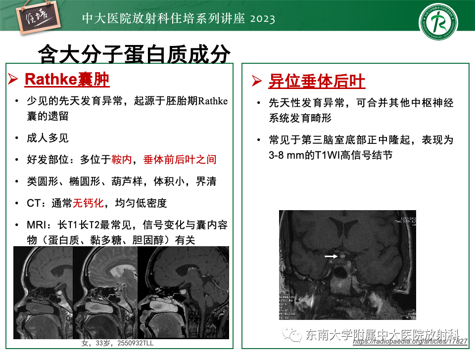 影像PPT - 【PPT】成人颅内T1WI高信号病变分析思路-19