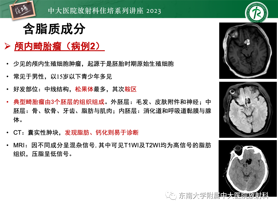 影像PPT - 【PPT】成人颅内T1WI高信号病变分析思路-26
