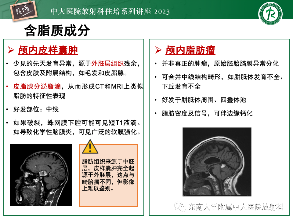 影像PPT - 【PPT】成人颅内T1WI高信号病变分析思路-27