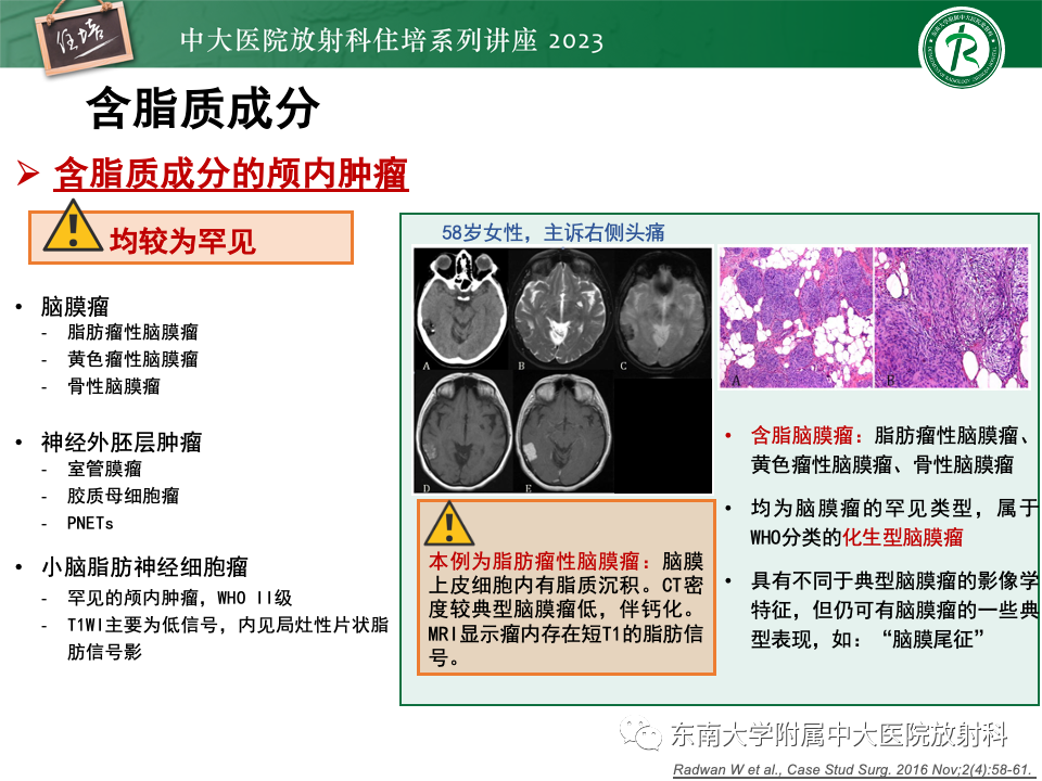 影像PPT - 【PPT】成人颅内T1WI高信号病变分析思路-28