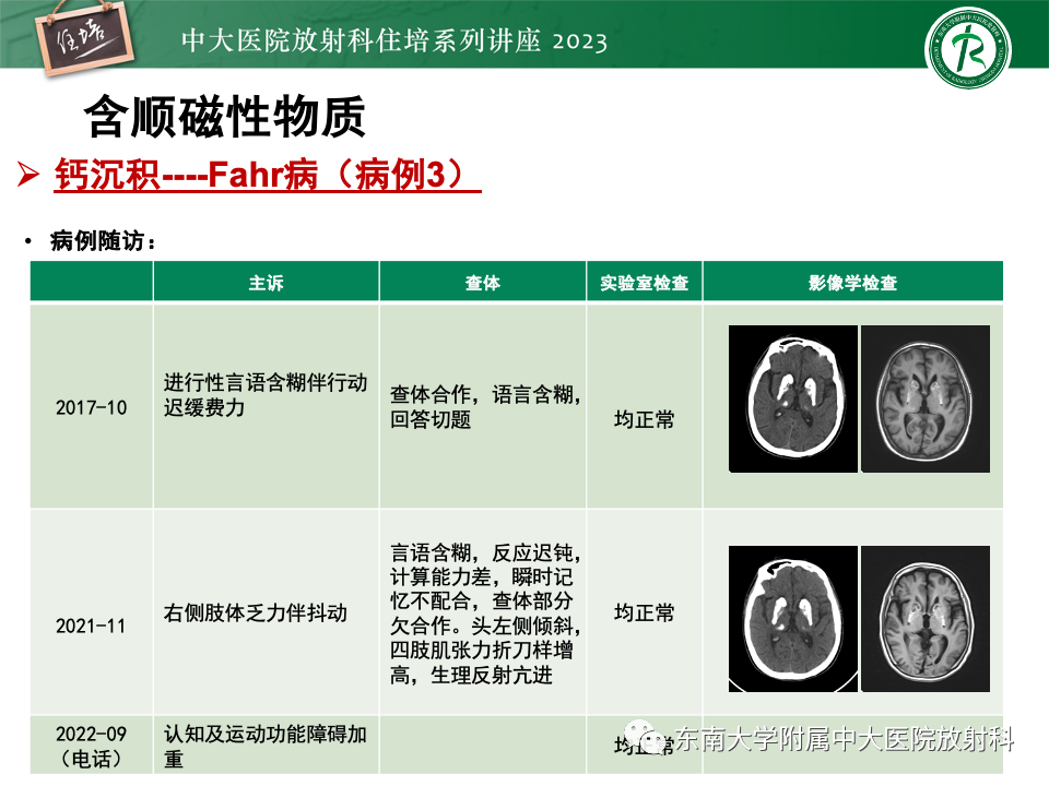 影像PPT - 【PPT】成人颅内T1WI高信号病变分析思路-35