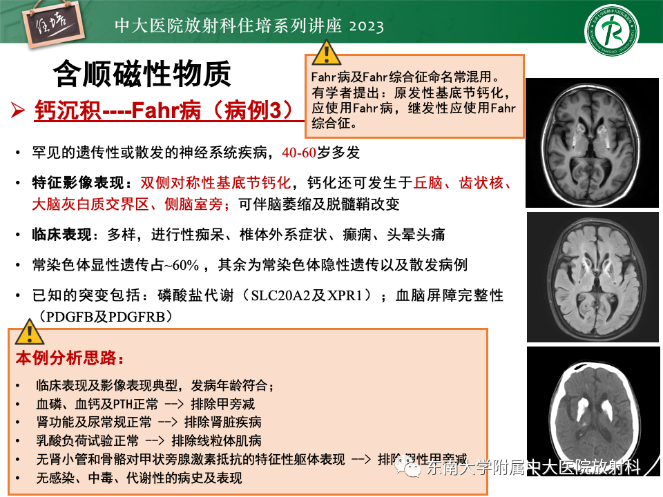 影像PPT - 【PPT】成人颅内T1WI高信号病变分析思路-36