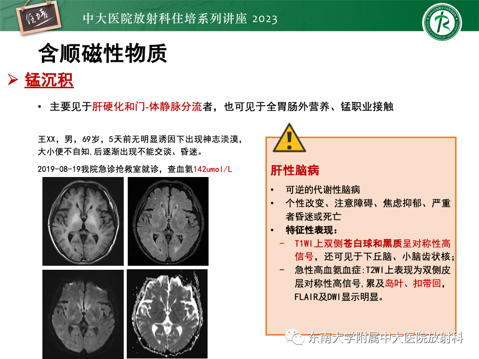影像PPT - 【PPT】成人颅内T1WI高信号病变分析思路-38