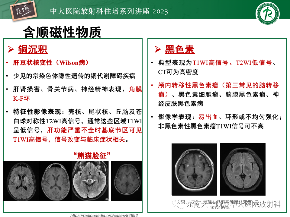 影像PPT - 【PPT】成人颅内T1WI高信号病变分析思路-39
