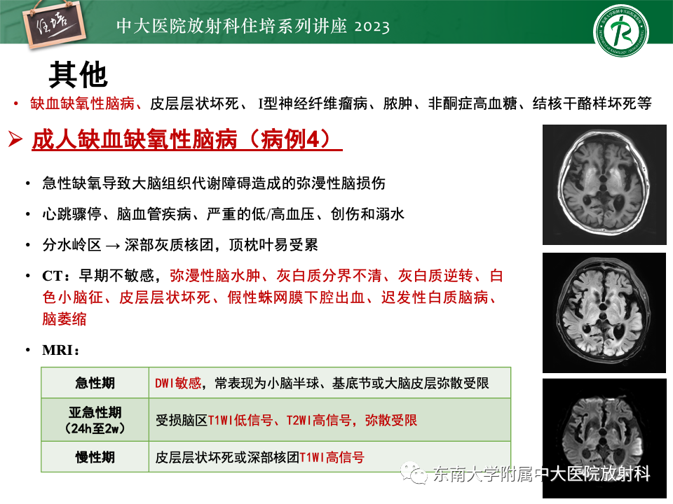 影像PPT - 【PPT】成人颅内T1WI高信号病变分析思路-46