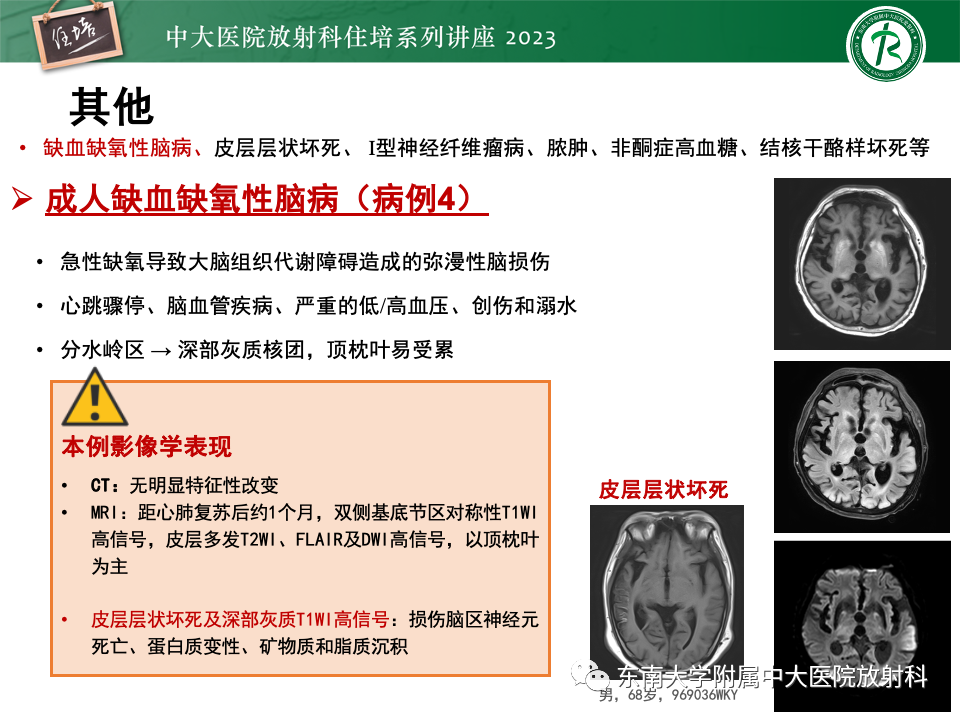 影像PPT - 【PPT】成人颅内T1WI高信号病变分析思路-47