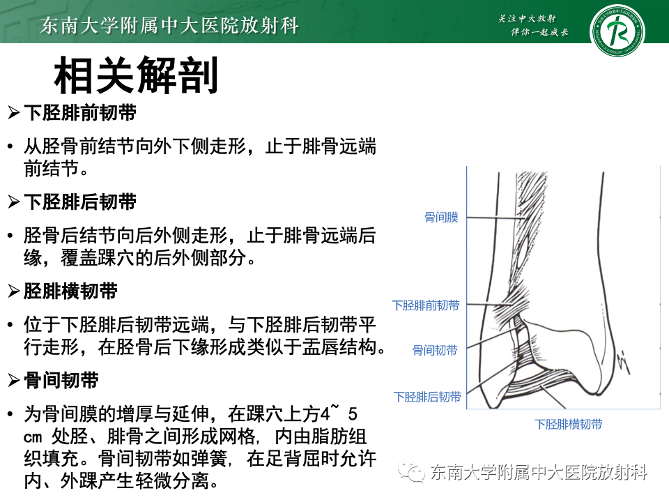 影像PPT - 【PPT】下胫腓联合分离损伤-5