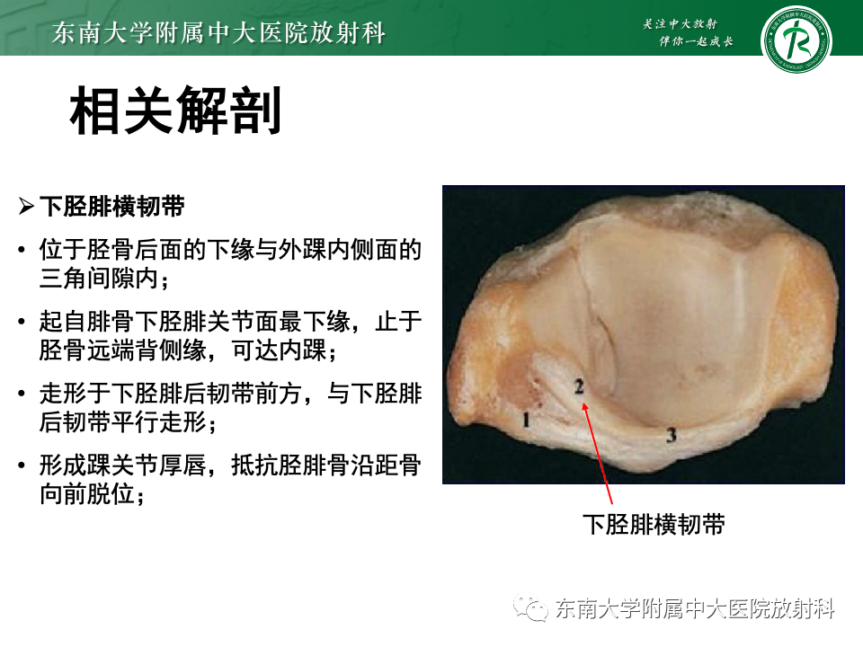 影像PPT - 【PPT】下胫腓联合分离损伤-8