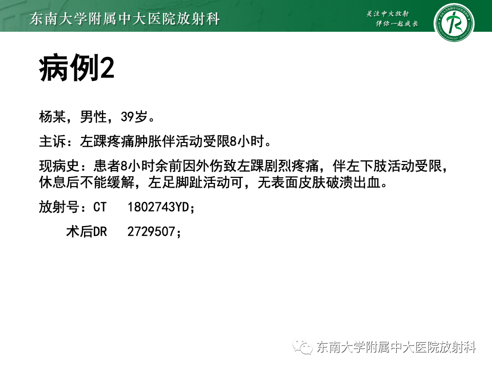 影像PPT - 【PPT】下胫腓联合分离损伤-17