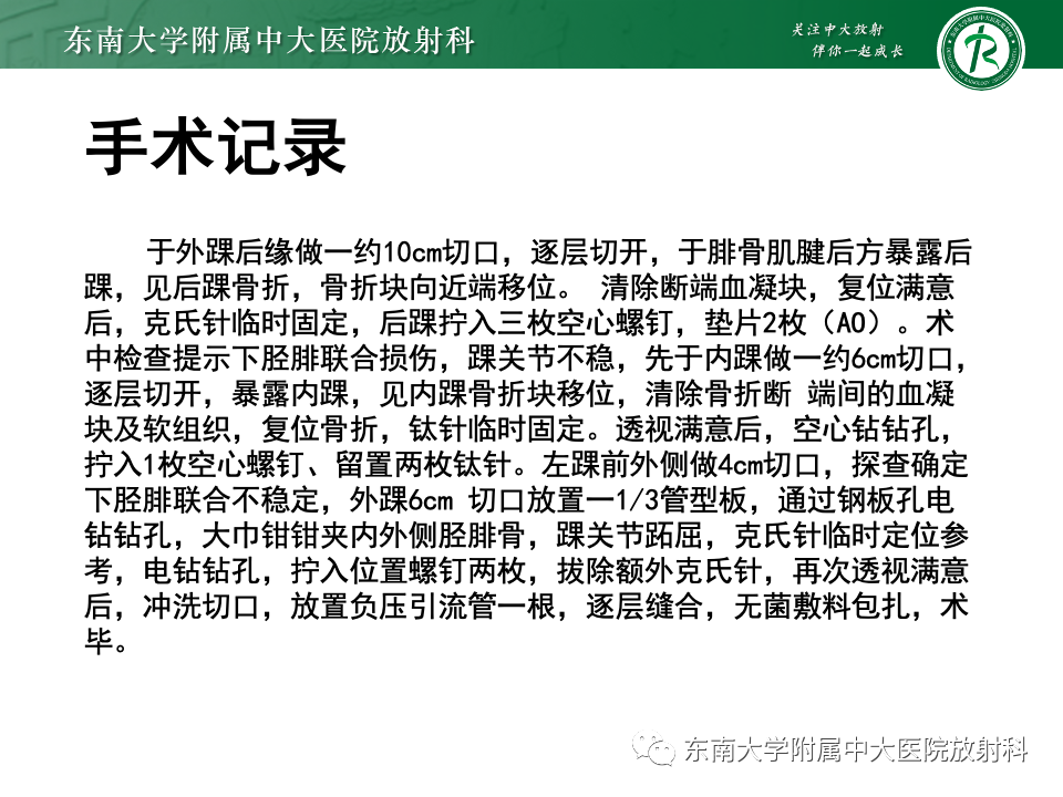 影像PPT - 【PPT】下胫腓联合分离损伤-19
