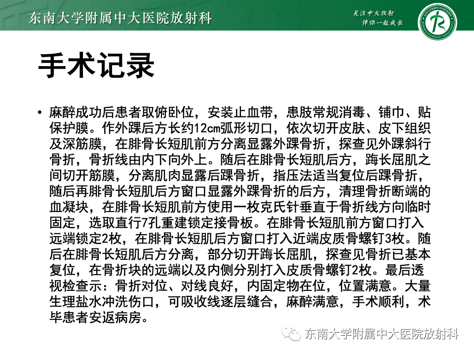 影像PPT - 【PPT】下胫腓联合分离损伤-24