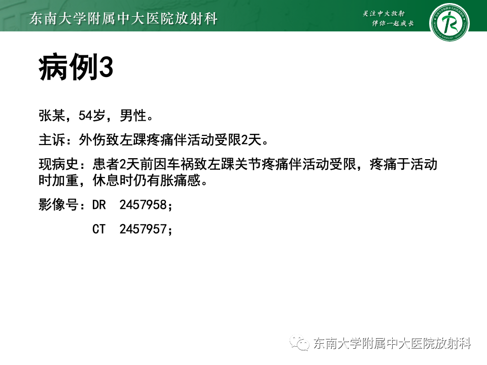 影像PPT - 【PPT】下胫腓联合分离损伤-22