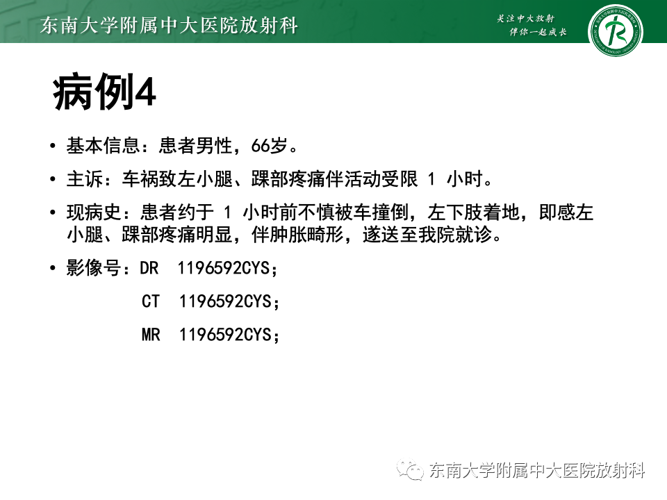 影像PPT - 【PPT】下胫腓联合分离损伤-32