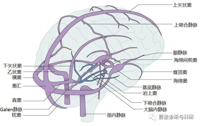 影像PPT - 静脉窦正常变异-1 影像PPT - 静脉窦正常变异-1