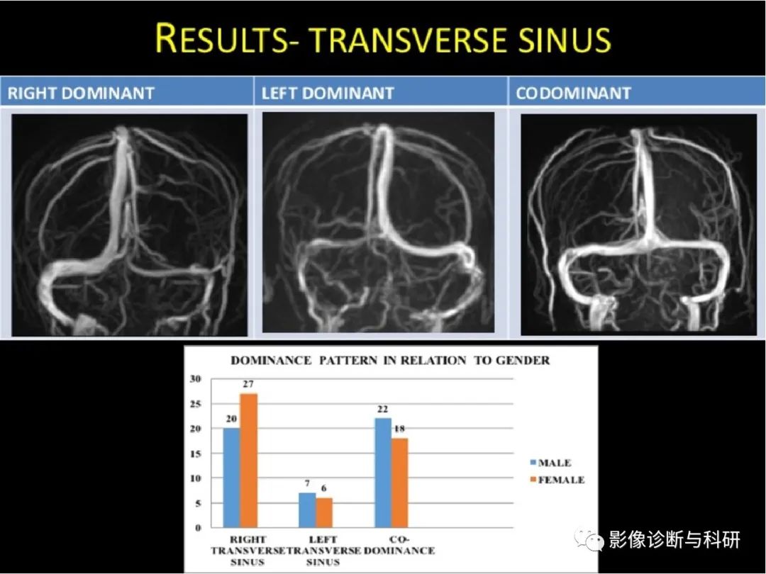 影像PPT - 静脉窦正常变异-3 影像PPT - 静脉窦正常变异-3