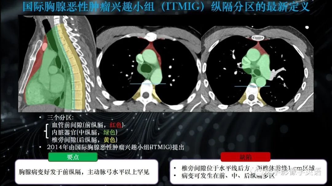 影像PPT - 【PPT】前纵隔肿块诊断要点及缺陷-8 影像PPT - 【PPT】前纵隔肿块诊断要点及缺陷-8