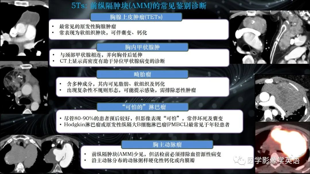 影像PPT - 【PPT】前纵隔肿块诊断要点及缺陷-12 影像PPT - 【PPT】前纵隔肿块诊断要点及缺陷-12