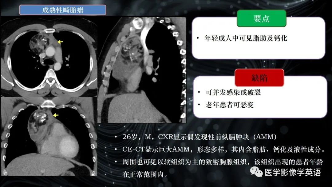 影像PPT - 【PPT】前纵隔肿块诊断要点及缺陷-22 影像PPT - 【PPT】前纵隔肿块诊断要点及缺陷-22