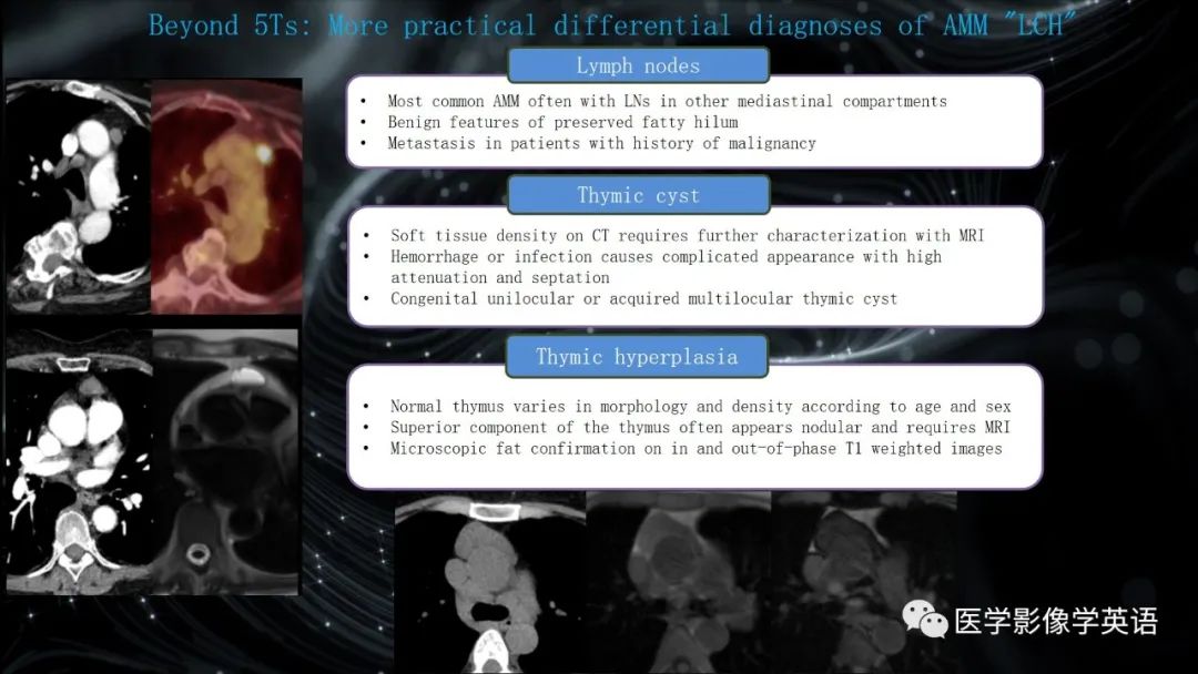 影像PPT - 【PPT】前纵隔肿块诊断要点及缺陷-27 影像PPT - 【PPT】前纵隔肿块诊断要点及缺陷-27