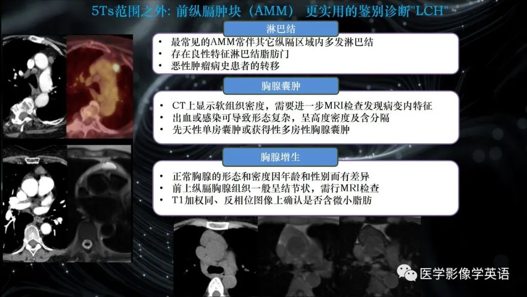 影像PPT - 【PPT】前纵隔肿块诊断要点及缺陷-28 影像PPT - 【PPT】前纵隔肿块诊断要点及缺陷-28