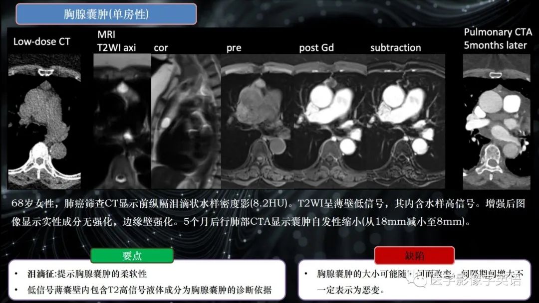 影像PPT - 【PPT】前纵隔肿块诊断要点及缺陷-34 影像PPT - 【PPT】前纵隔肿块诊断要点及缺陷-34