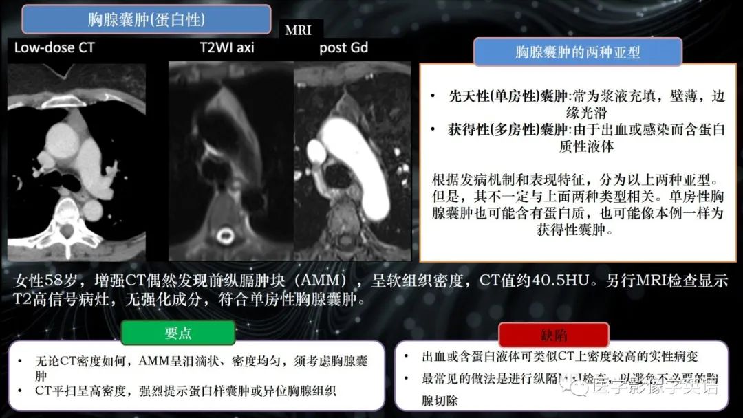 影像PPT - 【PPT】前纵隔肿块诊断要点及缺陷-36 影像PPT - 【PPT】前纵隔肿块诊断要点及缺陷-36