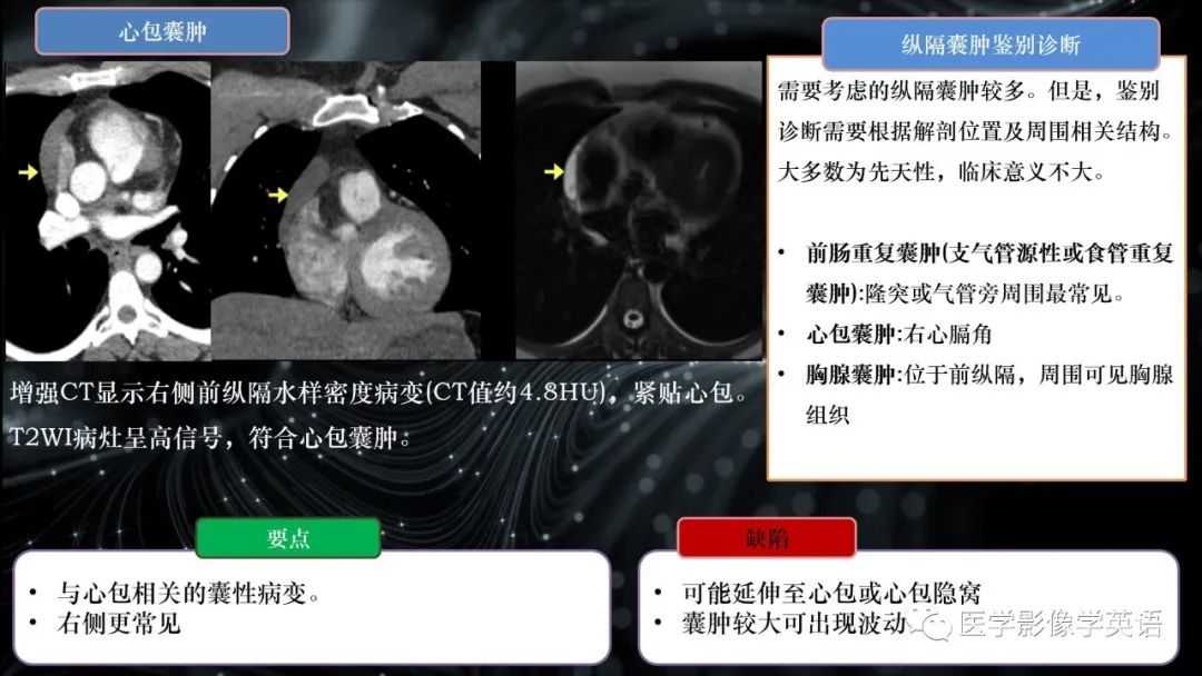 影像PPT - 【PPT】前纵隔肿块诊断要点及缺陷-38 影像PPT - 【PPT】前纵隔肿块诊断要点及缺陷-38
