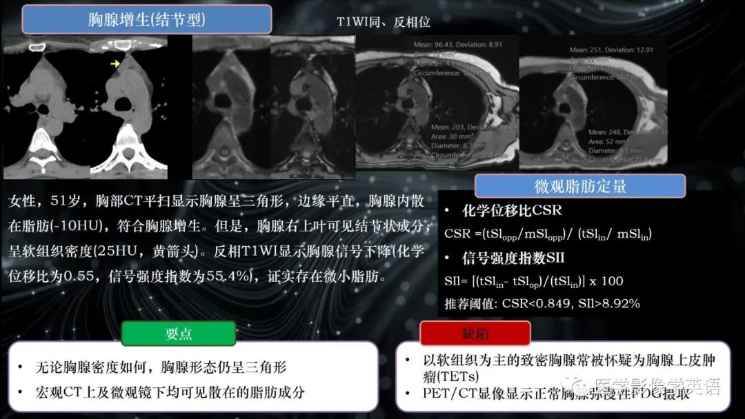 影像PPT - 【PPT】前纵隔肿块诊断要点及缺陷-40 影像PPT - 【PPT】前纵隔肿块诊断要点及缺陷-40
